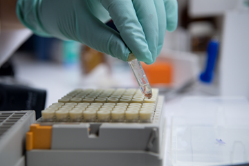 DNA extracted from snarge samples being sequenced